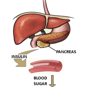 Blood Sugar Management